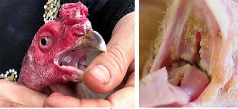 Có thể áp dụng các bài thuốc dân gian để chữa trị